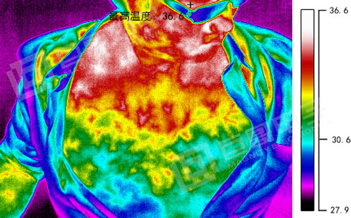 巨哥电子-热成像仪检测体表病变、炎症等